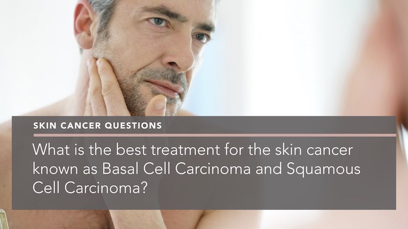 what-is-the-best-treatment-for-skin-cancer-known-as-basal-cell